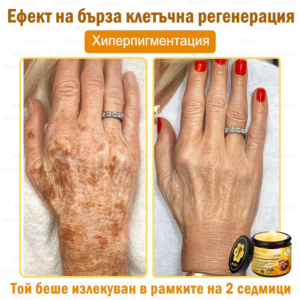 🎉 Честито! Вие сте нашият щастлив клиент за днес! 🎁 Само сега – получавате допълнителна отстъпка от -50%! ✨ Не се колебайте – специалната оферта на REHELY® е валидна само днес и няма да се повтори скоро!