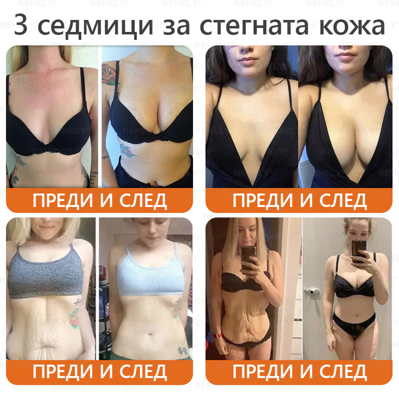 🎉 Честито! Вие сте нашият щастлив клиент за днес! 🎁 Само сега – получавате допълнителна отстъпка от -50%! ✨ Не се колебайте – специалната оферта на REHELY® е валидна само днес и няма да се повтори скоро!