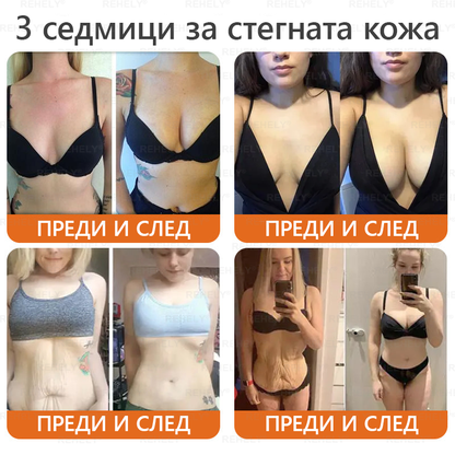 🎉 Честито! Вие сте нашият щастлив клиент за днес! 🎁 Само сега – получавате допълнителна отстъпка от -50%! ✨ Не се колебайте – специалната оферта на REHELY® е валидна само днес и няма да се повтори скоро!