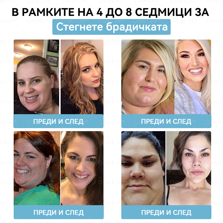🌿 CrazyLeaf® Слим & Виталити Тирезепатид 8 в 1 – орален разтвор (Само веднъж на ден – видими резултати само за 7 дни)  ✅ Подходящ за различни нужди: наднормено тегло, сърдечно-съдово здраве, диабет, сънна апнея, здраве на червата, ставни проблеми и други.