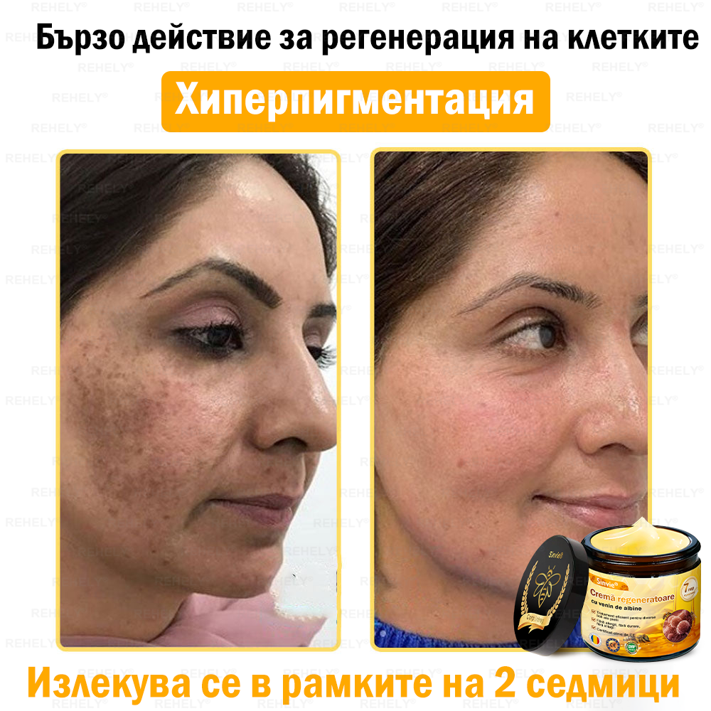 🎉 Честито! Вие сте нашият щастлив клиент за днес! 🎁 Само сега – получавате допълнителна отстъпка от -50%! ✨ Не се колебайте – специалната оферта на REHELY® е валидна само днес и няма да се повтори скоро!